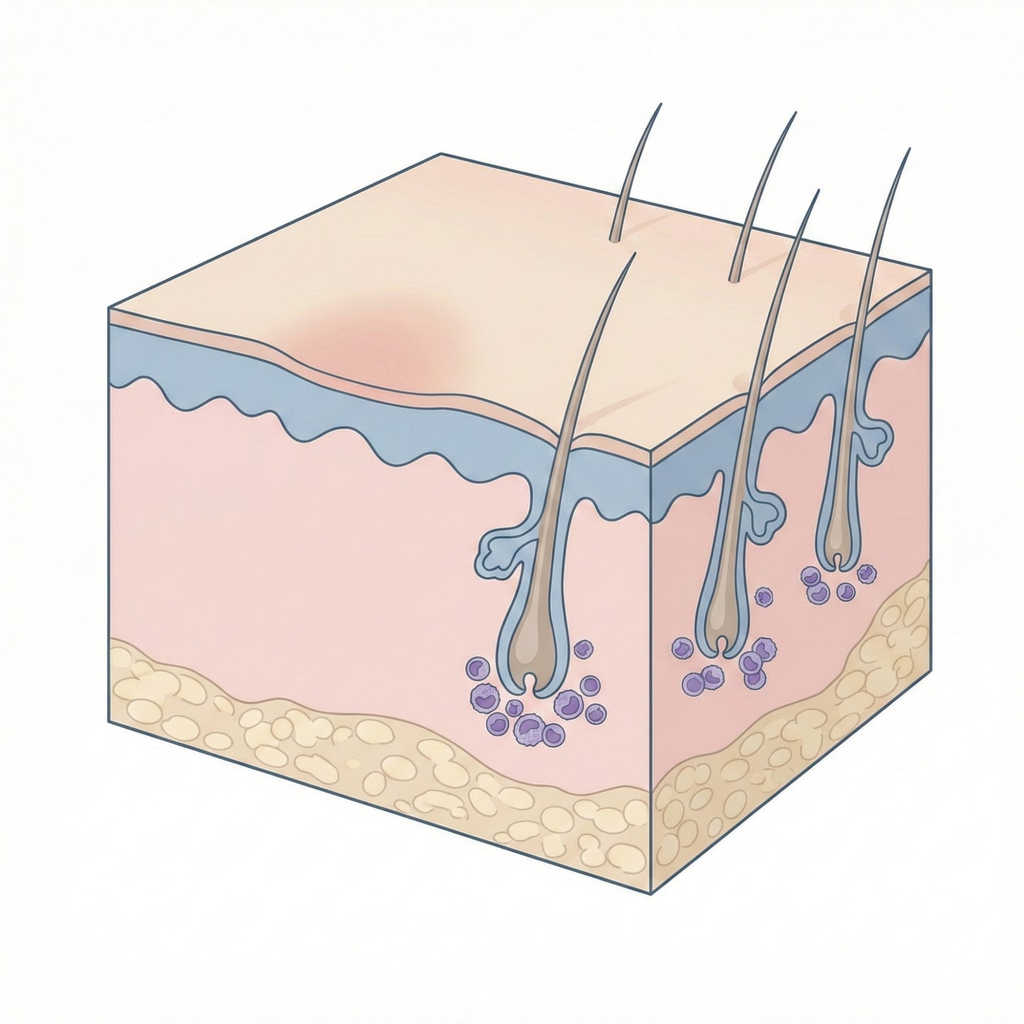 Schematische weergave van plaatselijke variatie in haarfollikelactiviteit