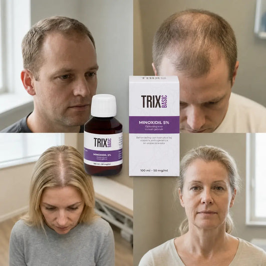 TRIX Basic Minoxidil 5% bij een haarprofiel met erfelijke haarverdunning.